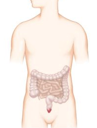 치핵 발병위치 이미지