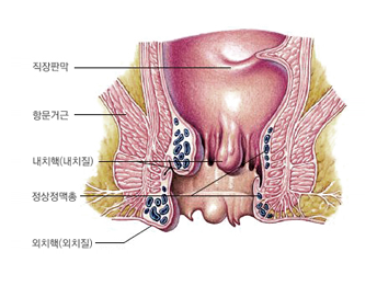 내치핵과 외치핵 이미지