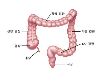 대장암 발병위치 이미지