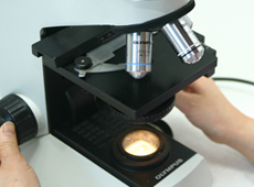 대장용종 이미지