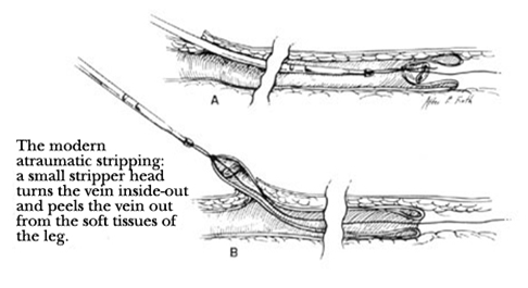하지거상 이미지