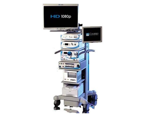 관절경 장비사진