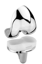 십자인대 보존형 이미지