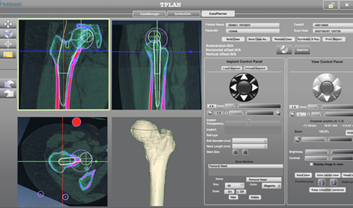 정상 무릎 설명이미지