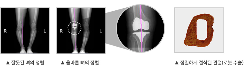 정상 무릎 설명이미지