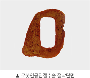 정상 무릎 설명이미지