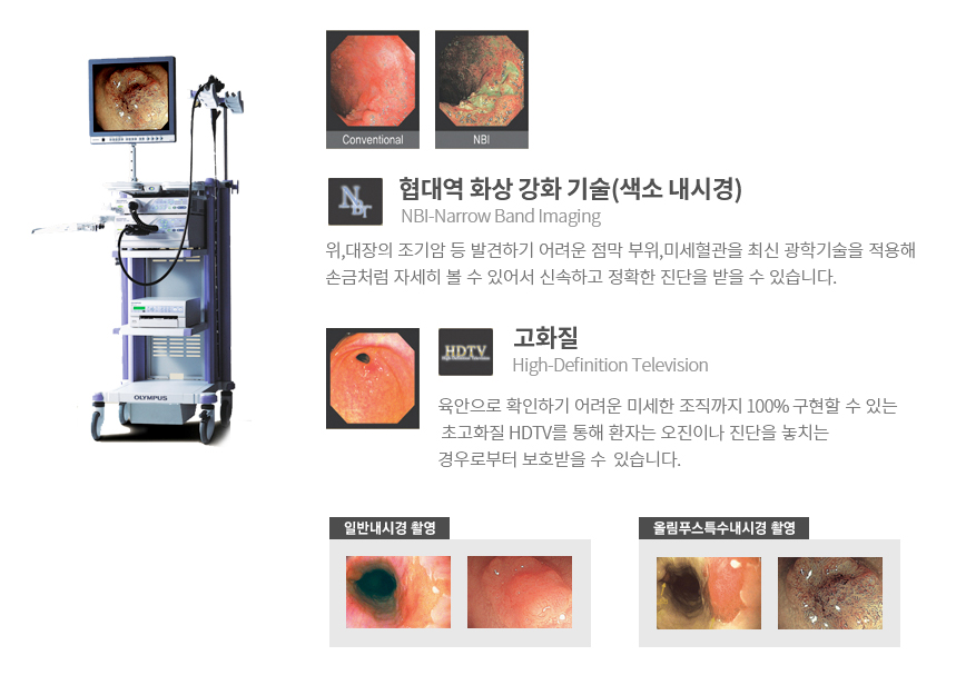 FULL HD 내시경 설명 이미지