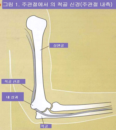 주관절에서의 척골 신경(주관절내측) 이미지
