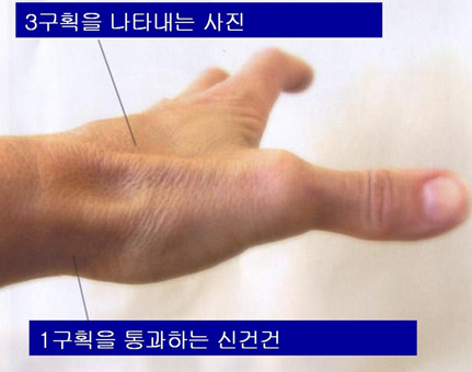 3구획을 나타내는 신전건  이미지