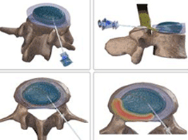 신경차단술  이미지